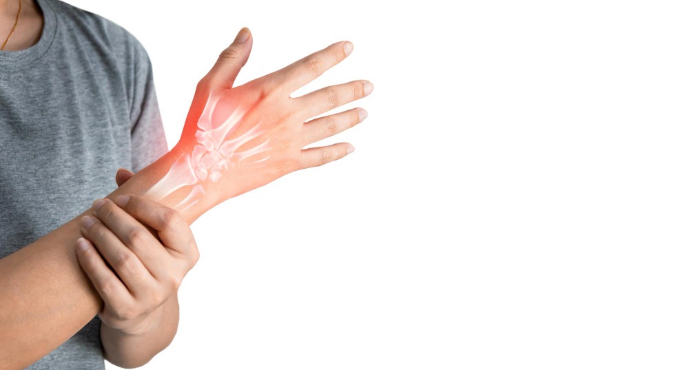 What Is Rheumatoid Arthritis? Causes, Symptoms & Key Facts